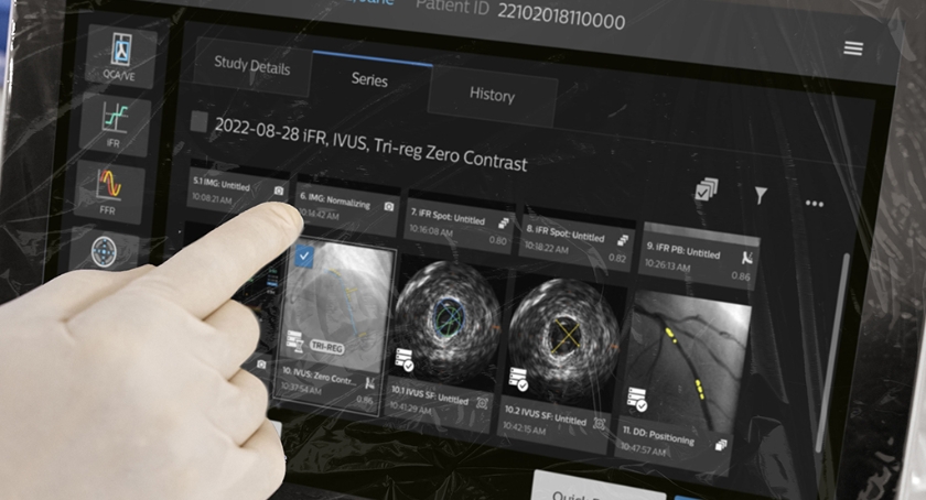Philips Releases IntraSight Plus Interventional Guidance System